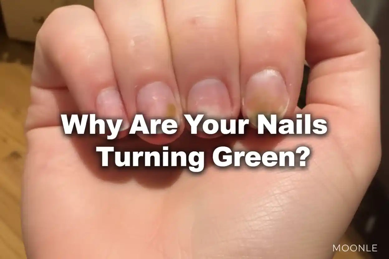 The Straight-Up Guide: Dealing with 'The Greenies' (Pseudomonas) - MOONLEE
